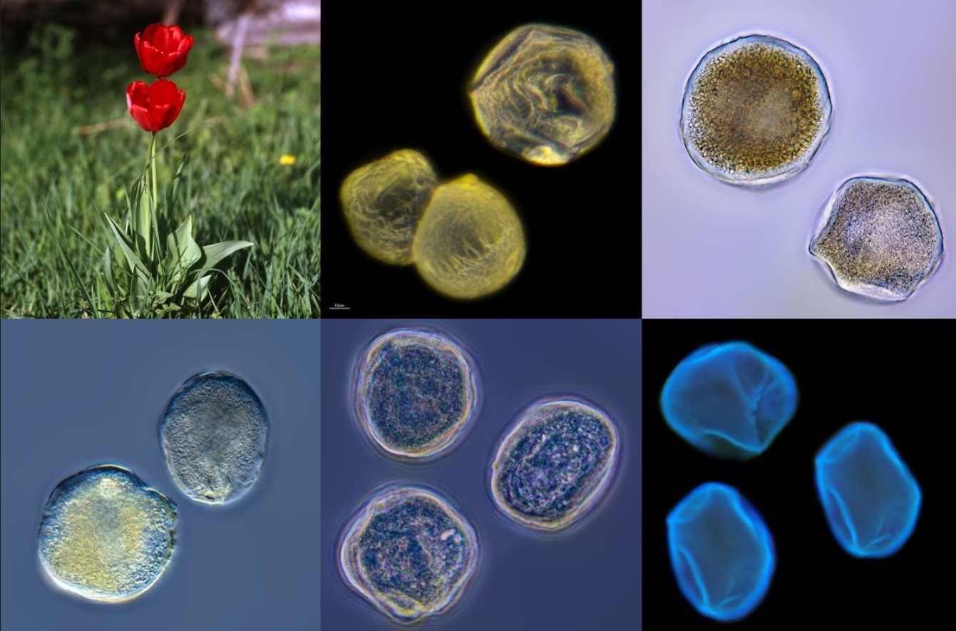 Как выглядит пыльца. Пыльца растений под микроскопом. Пыльца тюльпана под микроскопом. Пыльца сосны под микроскопом. Пыльца тюльпанапож микроскопам.